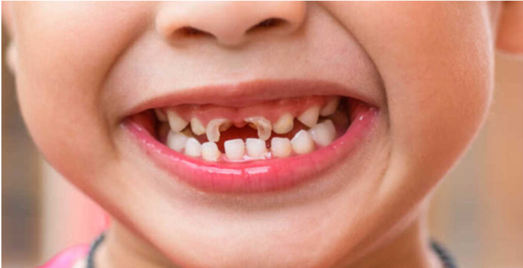pediatri-dentistry-category pediatri-dentistry-category